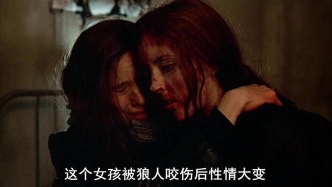 下车睡觉被狼咬伤,下车睡觉被狼咬伤了